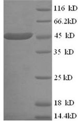 (Tris-Glycine gel) Discontinuous SDS-PAGE (reduced) with 5% enrichment gel and 15% separation gel.