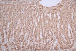 Immunohistochemistry of paraffin-embedded human thyroid tissue using CSB-PA897466LA01HU at dilution of 1:100