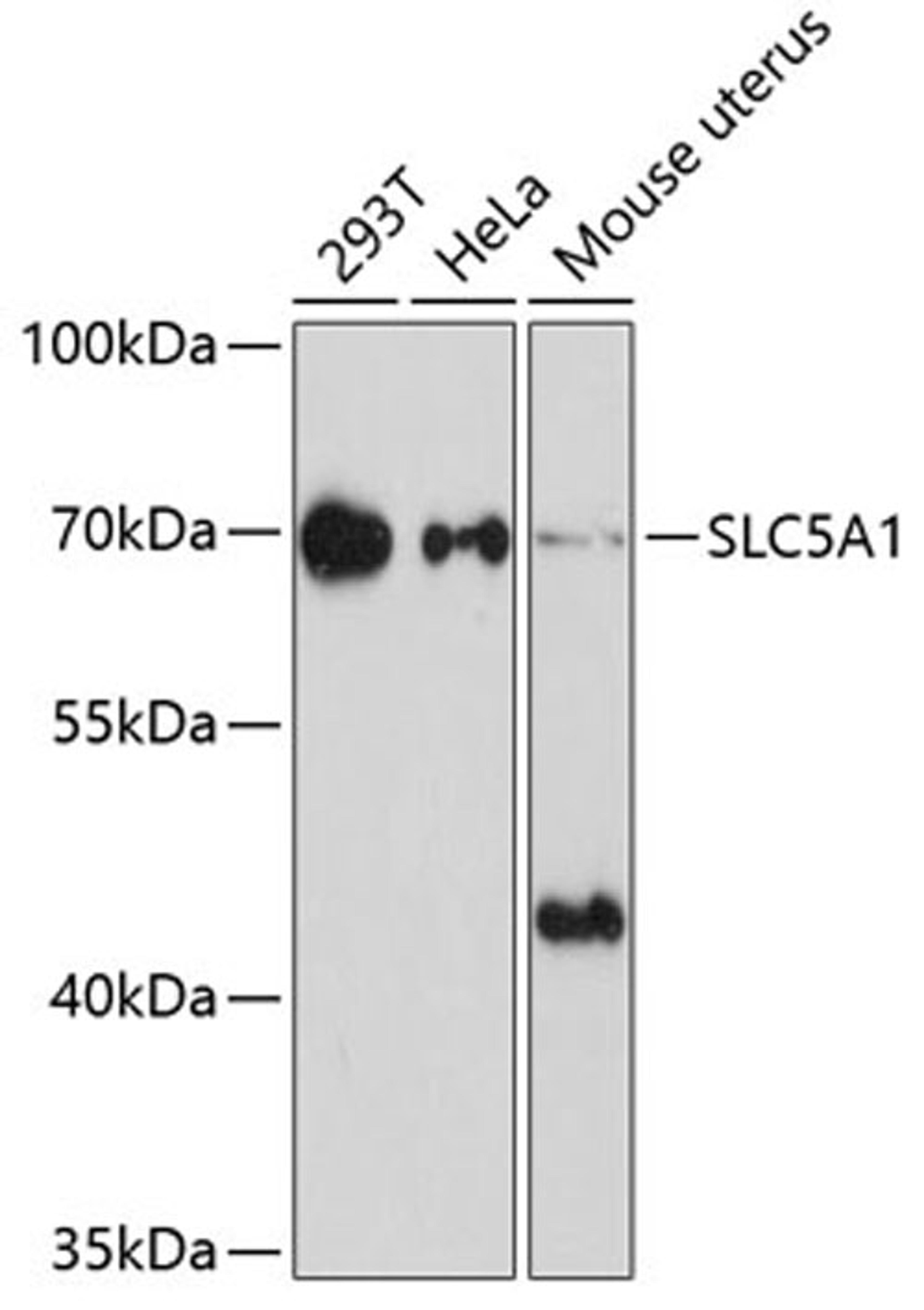 Western blot - SLC5A1 Antibody (A11976)