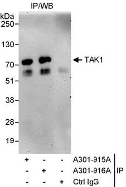 Detection of human TAK1 by western blot of immunoprecipitates.