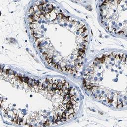 Immunohistochemistry: Claudin-11 Antibody [NBP1-82470] - Immunohistochemical staining of human testis shows strong membranous positivity in cells in seminiferus ducts.