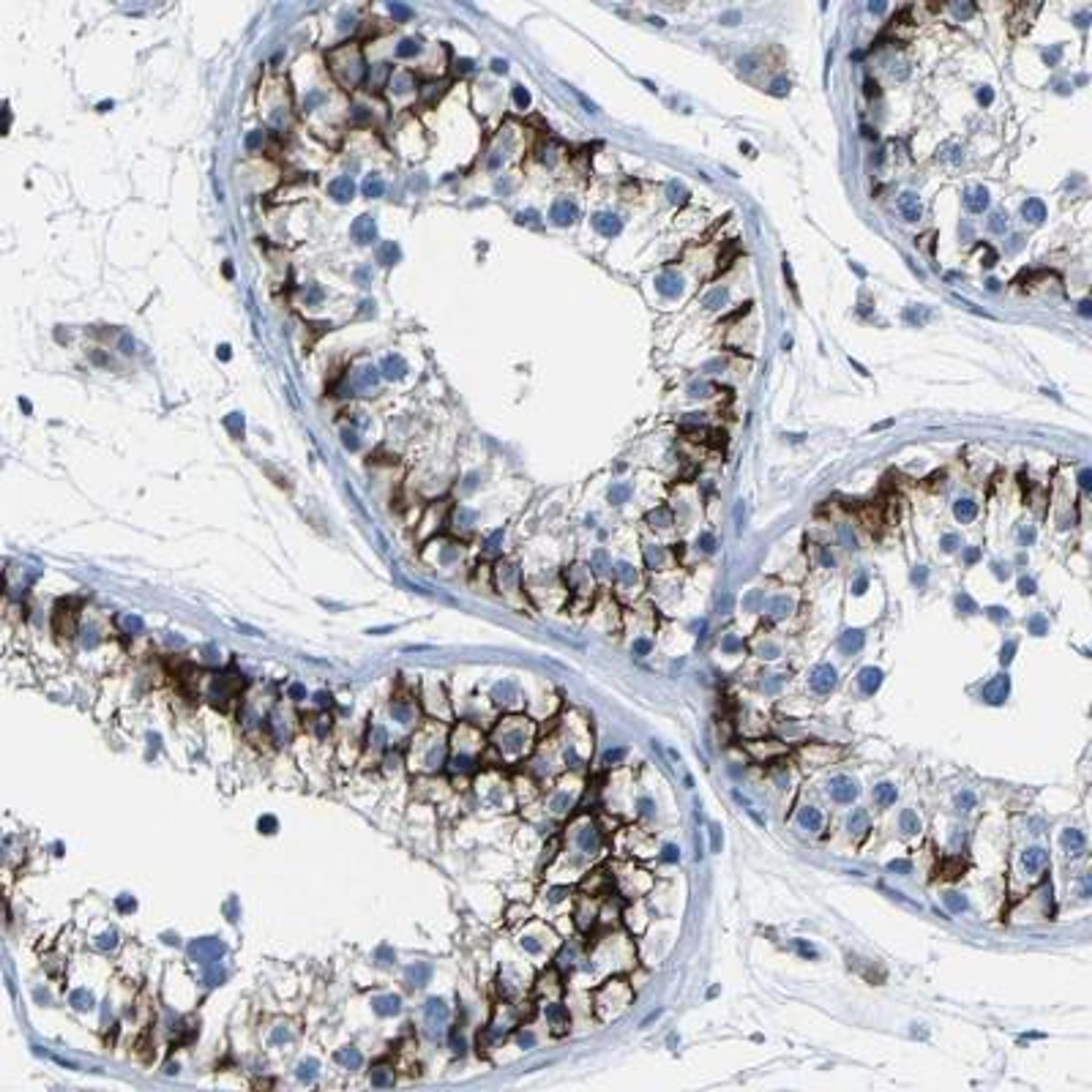 Immunohistochemistry: Claudin-11 Antibody [NBP1-82470] - Immunohistochemical staining of human testis shows strong membranous positivity in cells in seminiferus ducts.