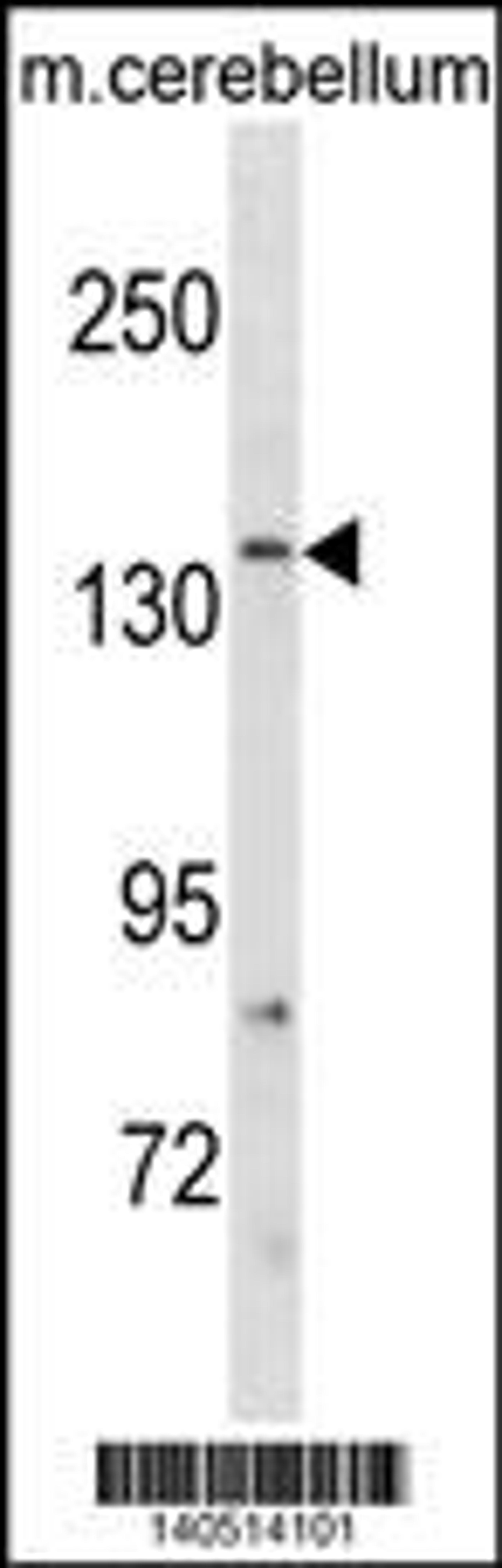 Western blot analysis in mouse cerebellum tissue lysates (35ug/lane).