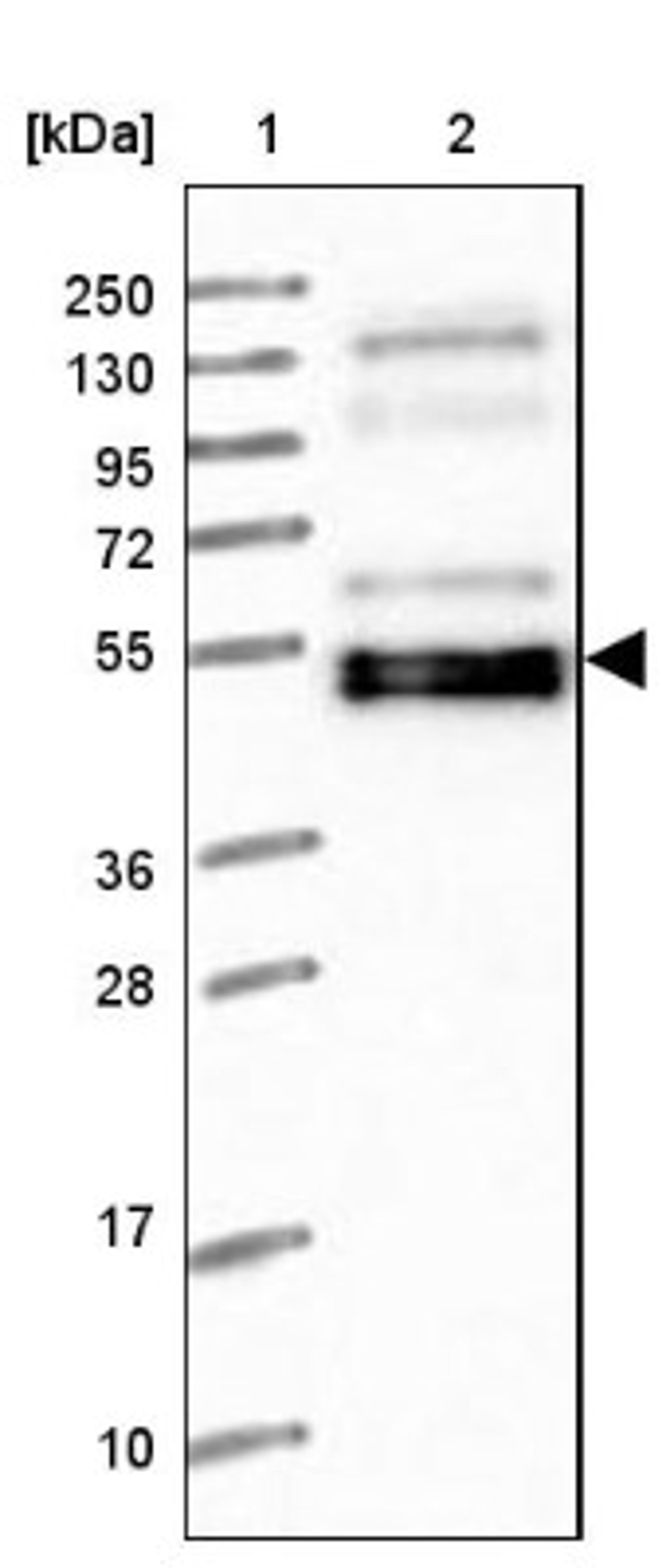 Western Blot: WAPL Antibody [NBP1-92579] - Lane 1: Marker [kDa] 250, 130, 95, 72, 55, 36, 28, 17, 10<br/>Lane 2: Human cell line RT-4