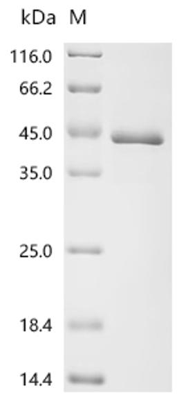 (Tris-Glycine gel) Discontinuous SDS-PAGE (reduced) with 5% enrichment gel and 15% separation gel.