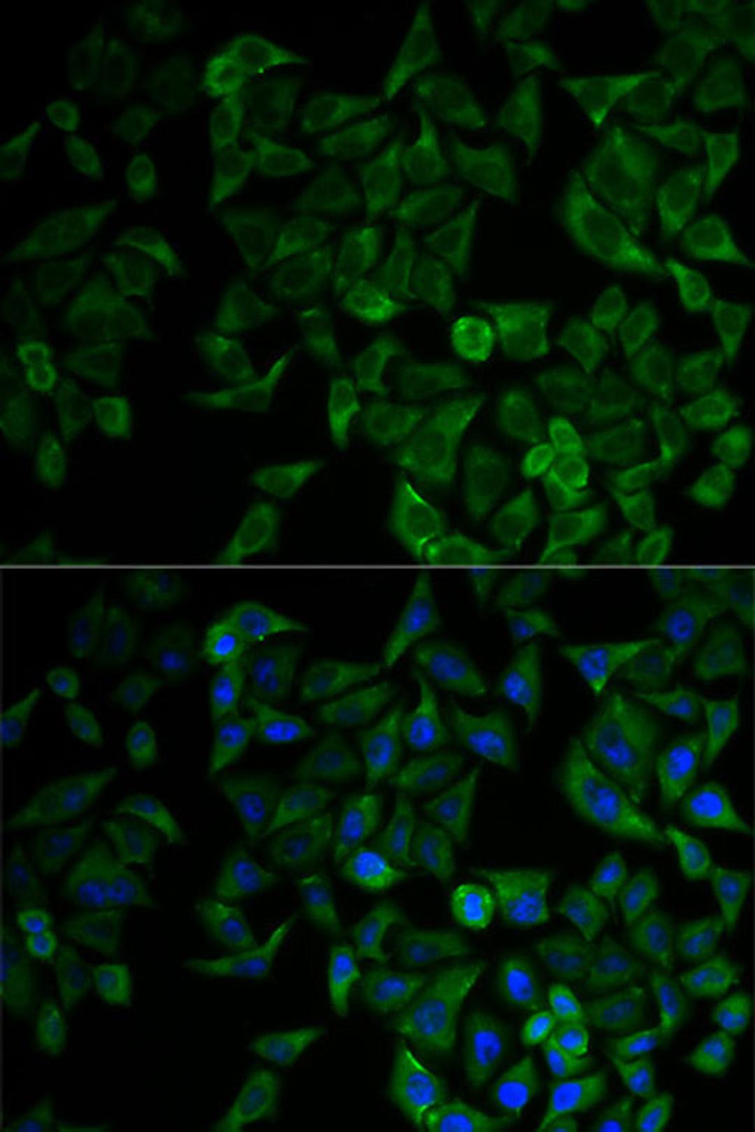 Immunofluorescence - TNFRSF1A antibody (A0033)