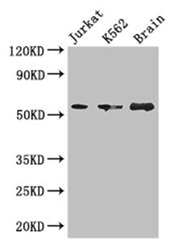 Western Blot. Positive WB detected in: Jurkat whole cell lysate, K562 whole cell lysate, Mouse brain tissue. All lanes: KIAA0513 antibody at 2.7µg/ml. Secondary. Goat polyclonal to rabbit IgG at 1/50000 dilution. Predicted band size: 47, 34, 46 kDa. Observed band size: 57 kDa
