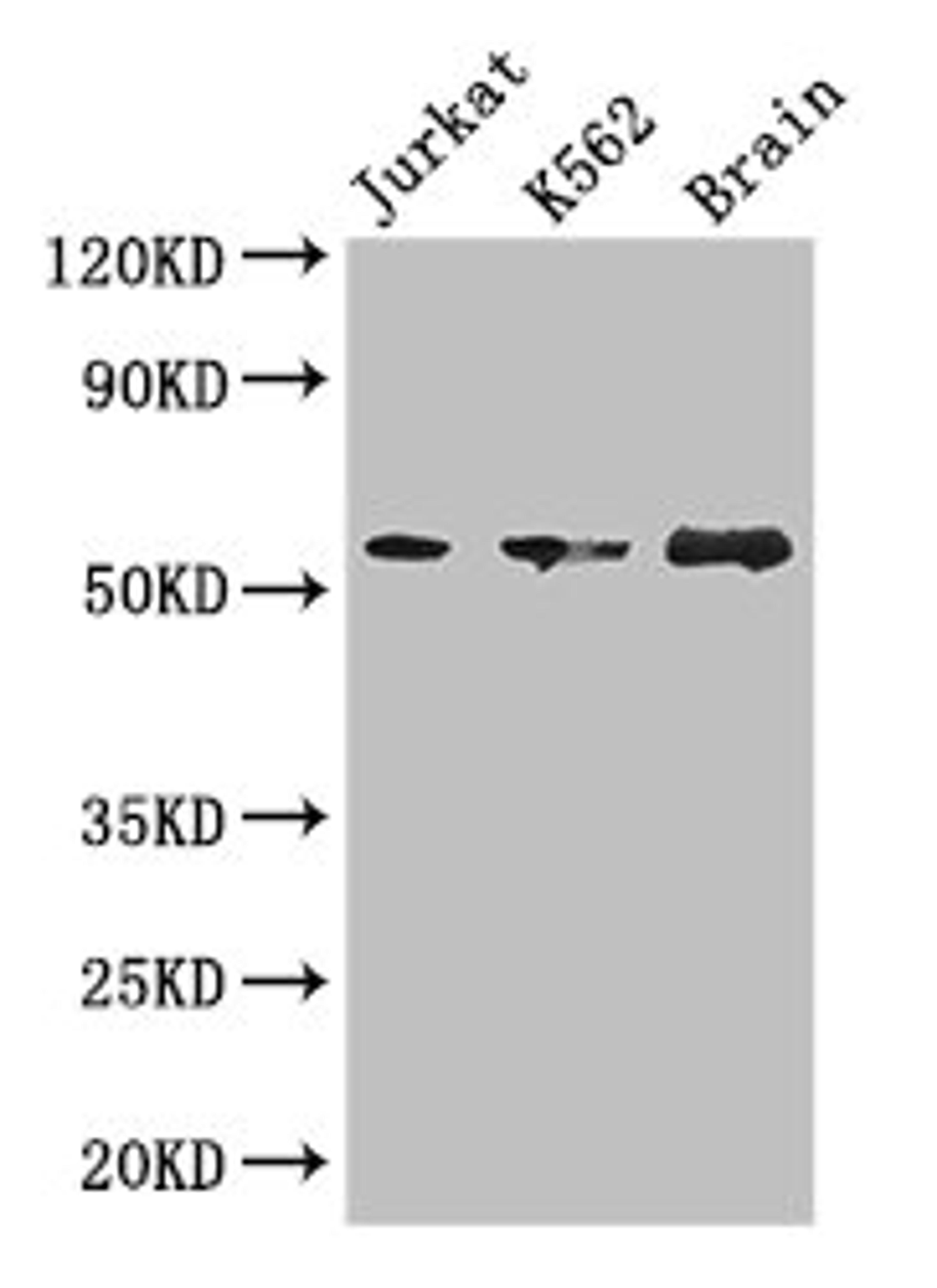 Western Blot. Positive WB detected in: Jurkat whole cell lysate, K562 whole cell lysate, Mouse brain tissue. All lanes: KIAA0513 antibody at 2.7µg/ml. Secondary. Goat polyclonal to rabbit IgG at 1/50000 dilution. Predicted band size: 47, 34, 46 kDa. Observed band size: 57 kDa