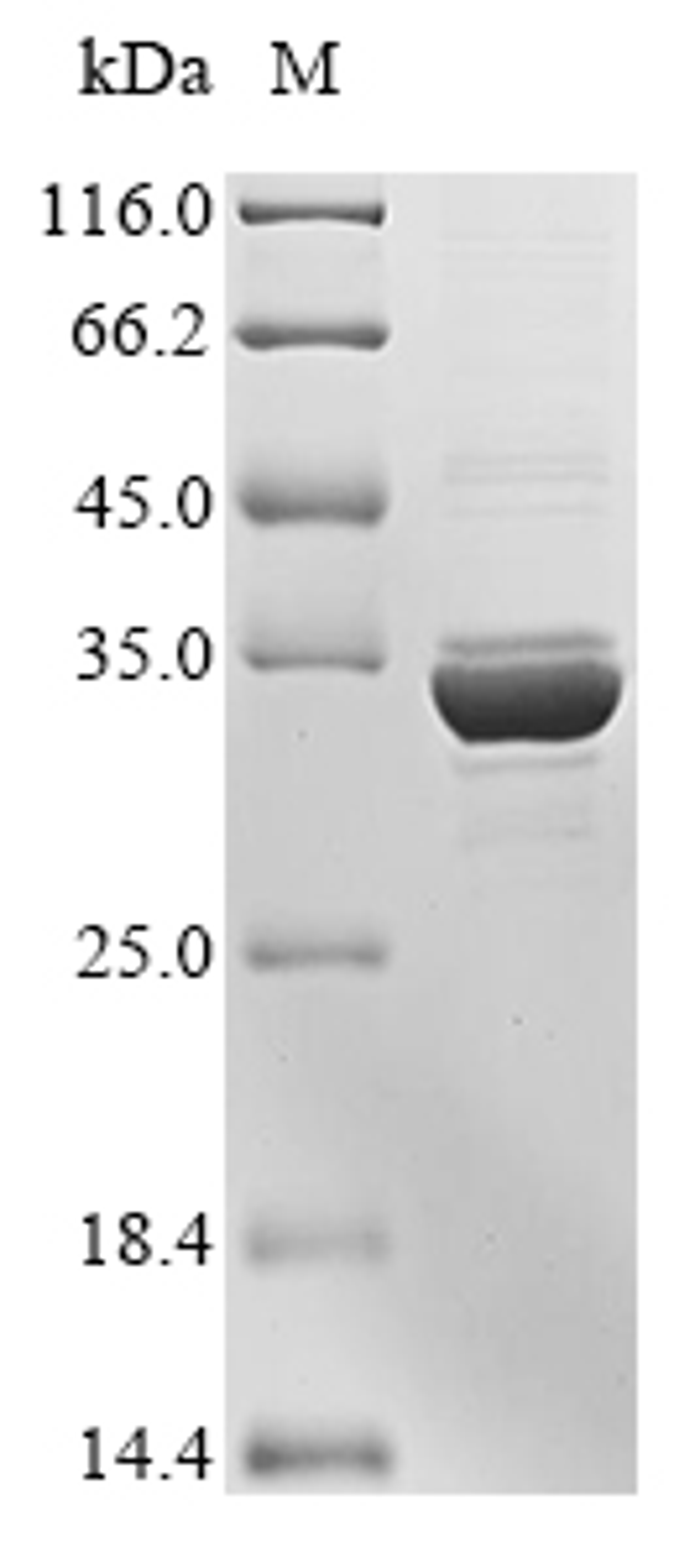 (Tris-Glycine gel) Discontinuous SDS-PAGE (reduced) with 5% enrichment gel and 15% separation gel.