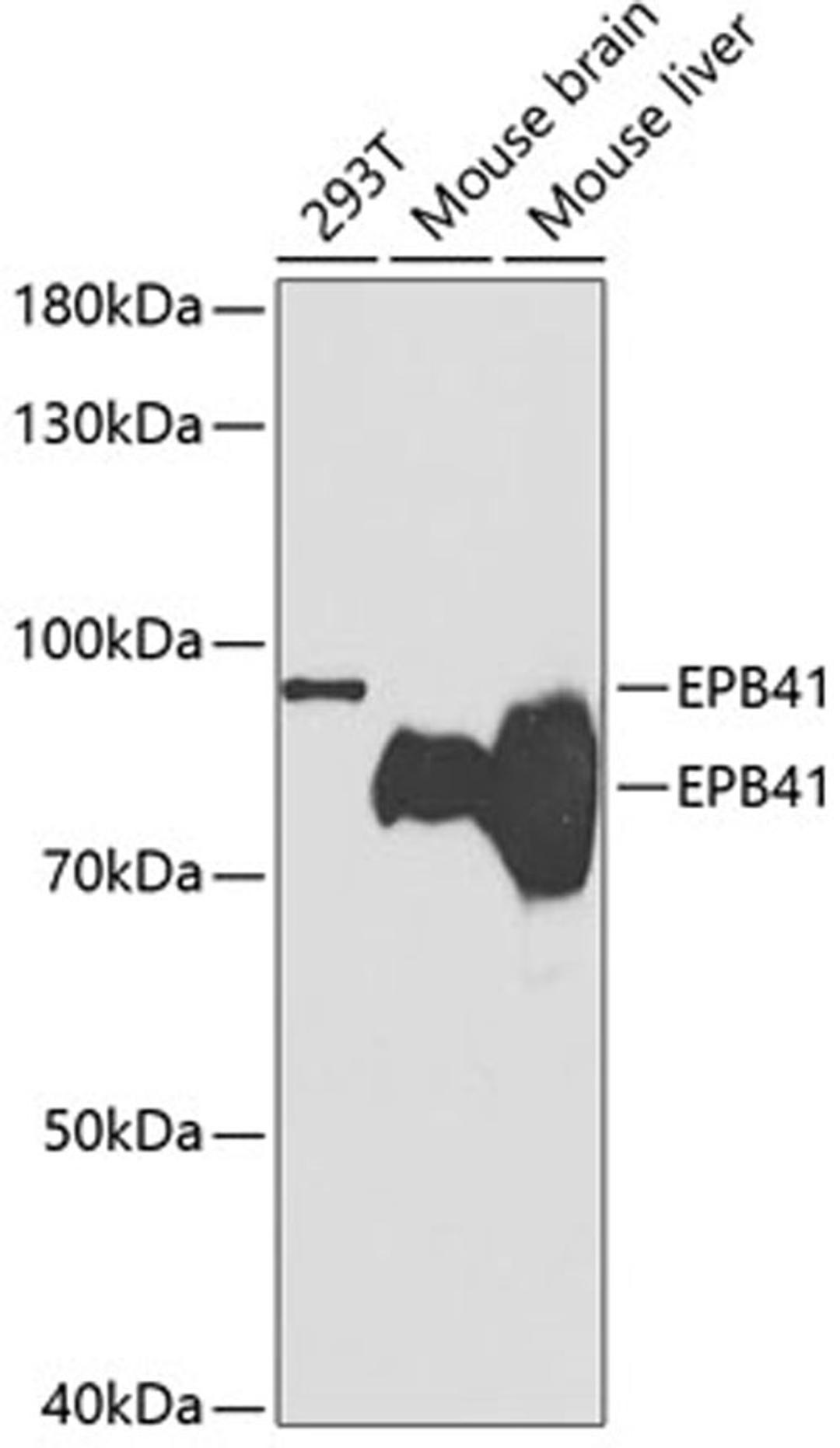 Western blot - EPB41 antibody (A2490)