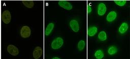 Stable HeLa cell line expressing YFP-fusion protein (A). Cells were stained with protag-HiRes anti-GFP-X1 Atto 488 (B, Cat. No. 81105) and protag-HiRes anti-GFP-X4 Atto 488  (C, Cat. No. 81405)(courtesy of NanoTag Biotechnologies GmbH).