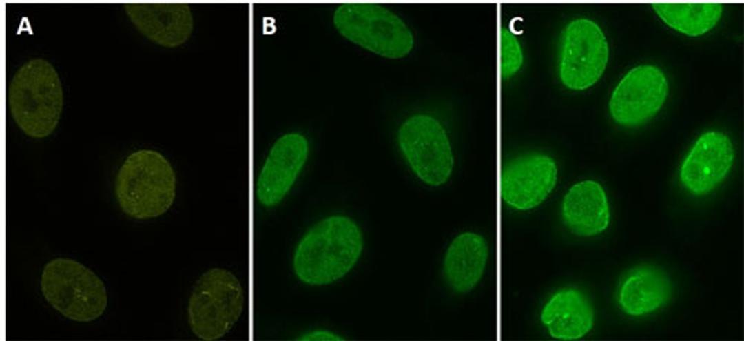 Stable HeLa cell line expressing YFP-fusion protein (A). Cells were stained with protag-HiRes anti-GFP-X1 Atto 488 (B, Cat. No. 81105) and protag-HiRes anti-GFP-X4 Atto 488 (C, Cat. No. 81405)(courtesy of NanoTag Biotechnologies GmbH).