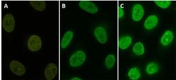 Stable HeLa cell line expressing YFP-fusion protein (A). Cells were stained with protag-HiRes anti-GFP-X1 Atto 488 (B, Cat. No. 81105) and protag-HiRes anti-GFP-X4 Atto 488 (C, Cat. No. 81405)(courtesy of NanoTag Biotechnologies GmbH).