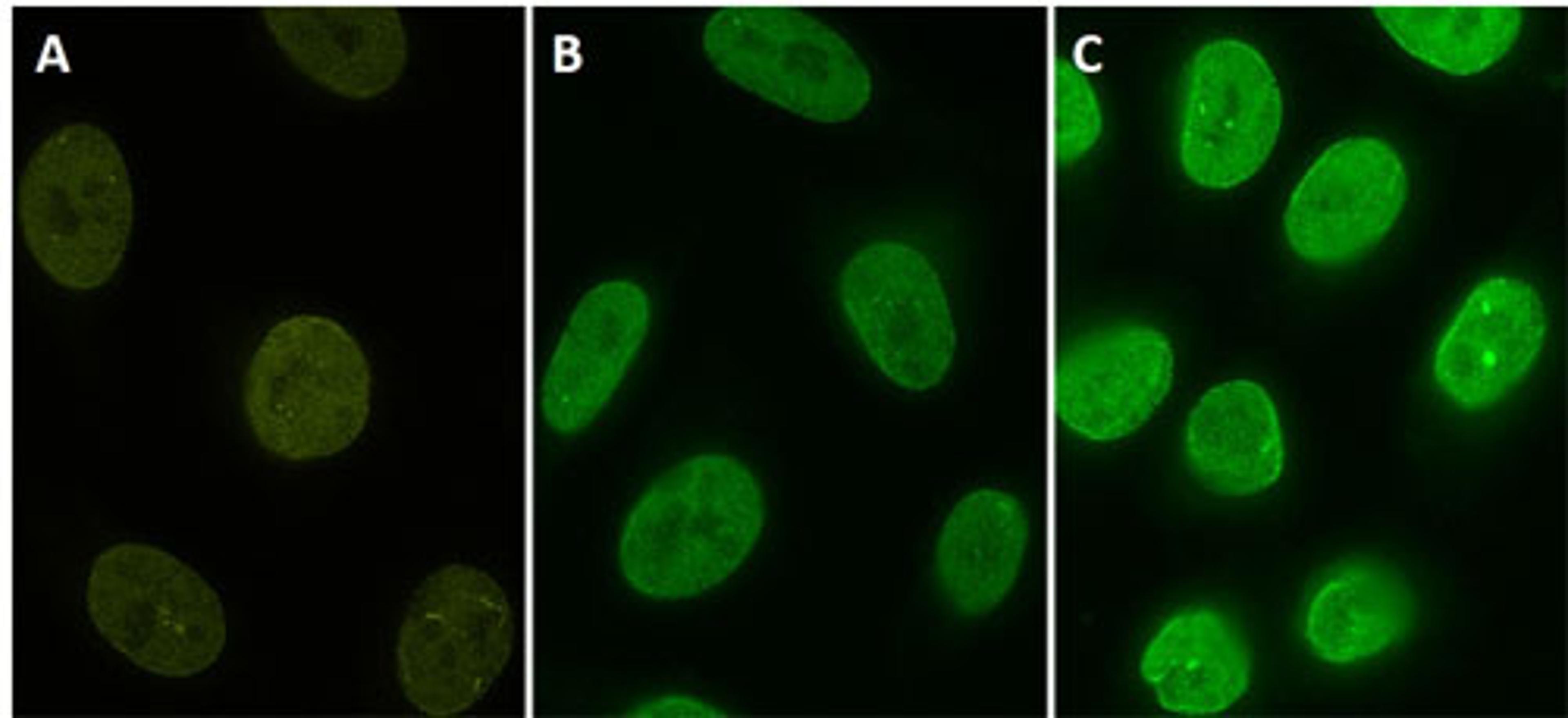 Stable HeLa cell line expressing YFP-fusion protein (A). Cells were stained with protag-HiRes anti-GFP-X1 Atto 488 (B, Cat. No. 81105) and protag-HiRes anti-GFP-X4 Atto 488 (C, Cat. No. 81405)(courtesy of NanoTag Biotechnologies GmbH).