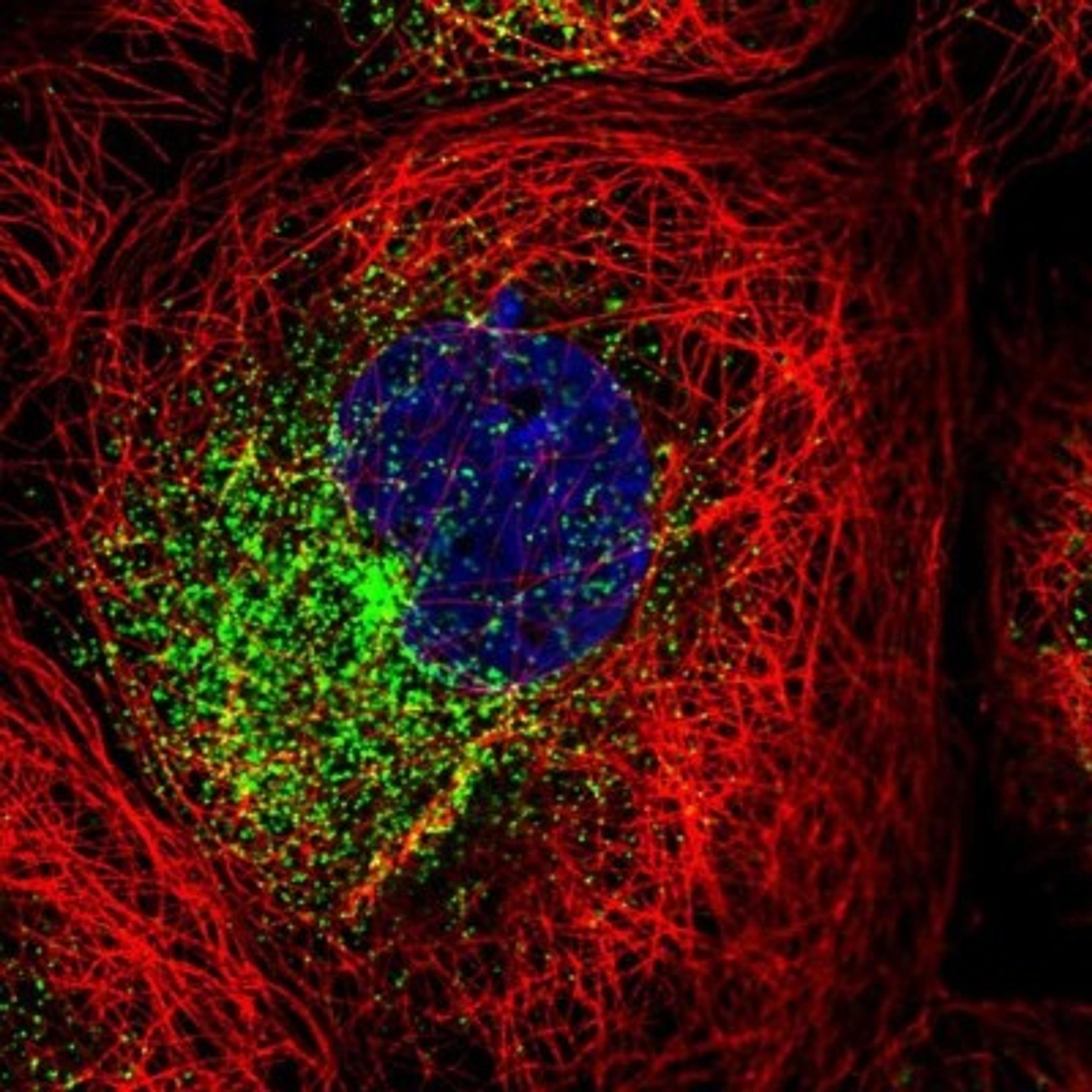 Immunofluorescence: FIP1/RCP Antibody [NBP1-83600] - Staining of human cell line A-431 shows positivity in vesicles.