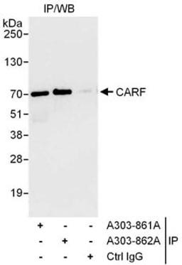 Detection of human CARF by western blot of immunoprecipitates.