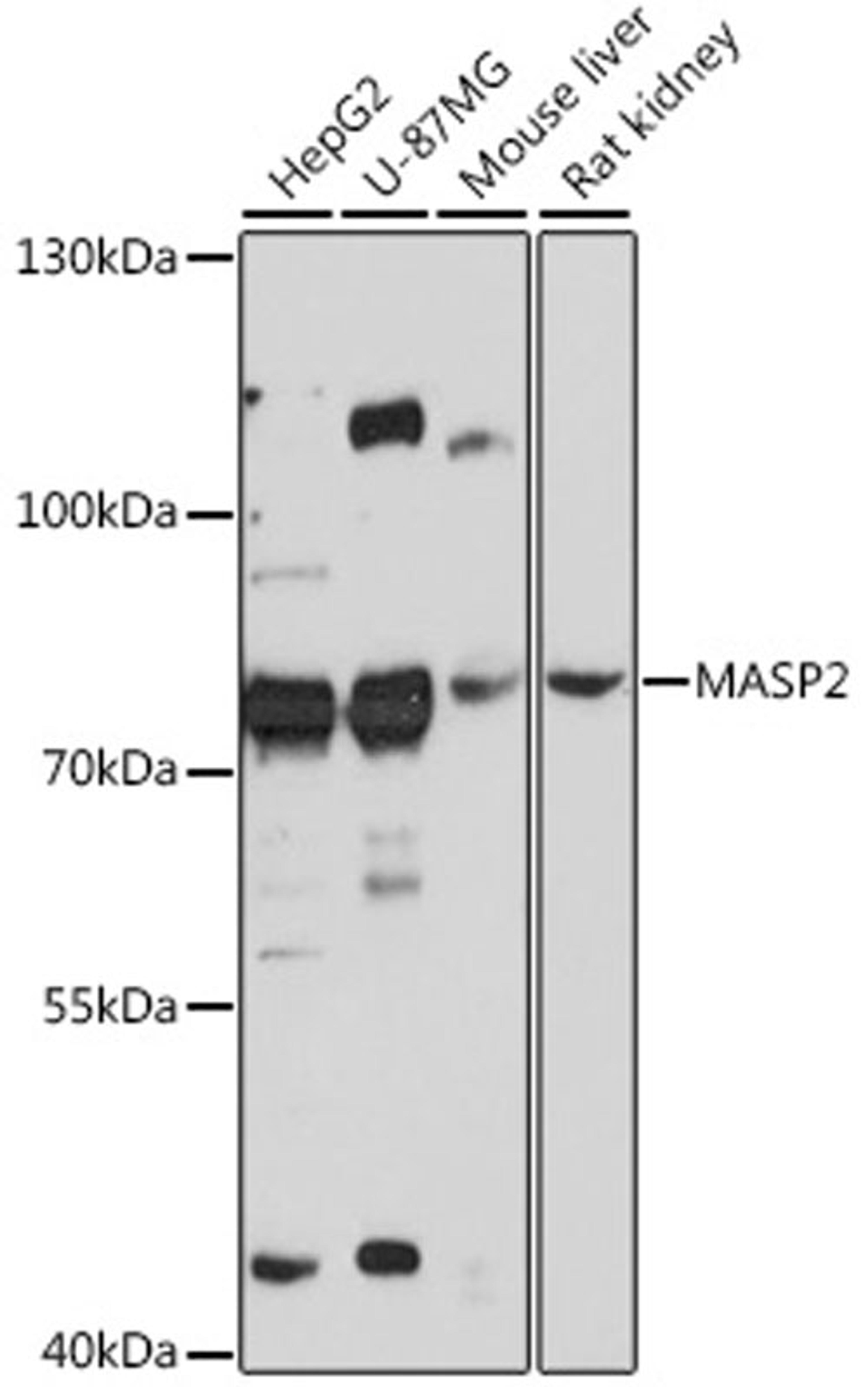 Western blot - MASP2 antibody (A16030)