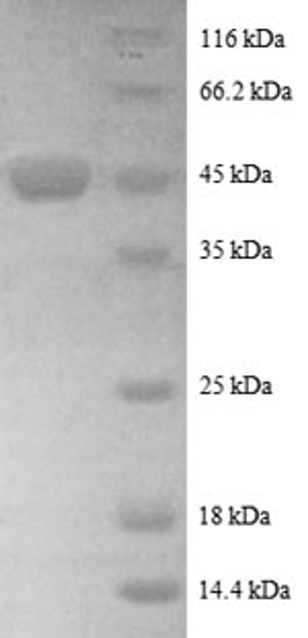(Tris-Glycine gel) Discontinuous SDS-PAGE (reduced) with 5% enrichment gel and 15% separation gel.