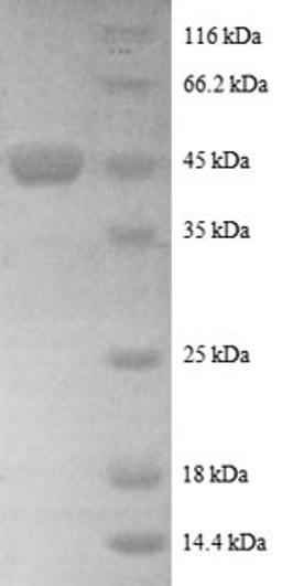 (Tris-Glycine gel) Discontinuous SDS-PAGE (reduced) with 5% enrichment gel and 15% separation gel.