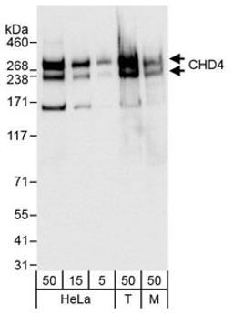 Detection of human and mouse CHD4 by western blot.