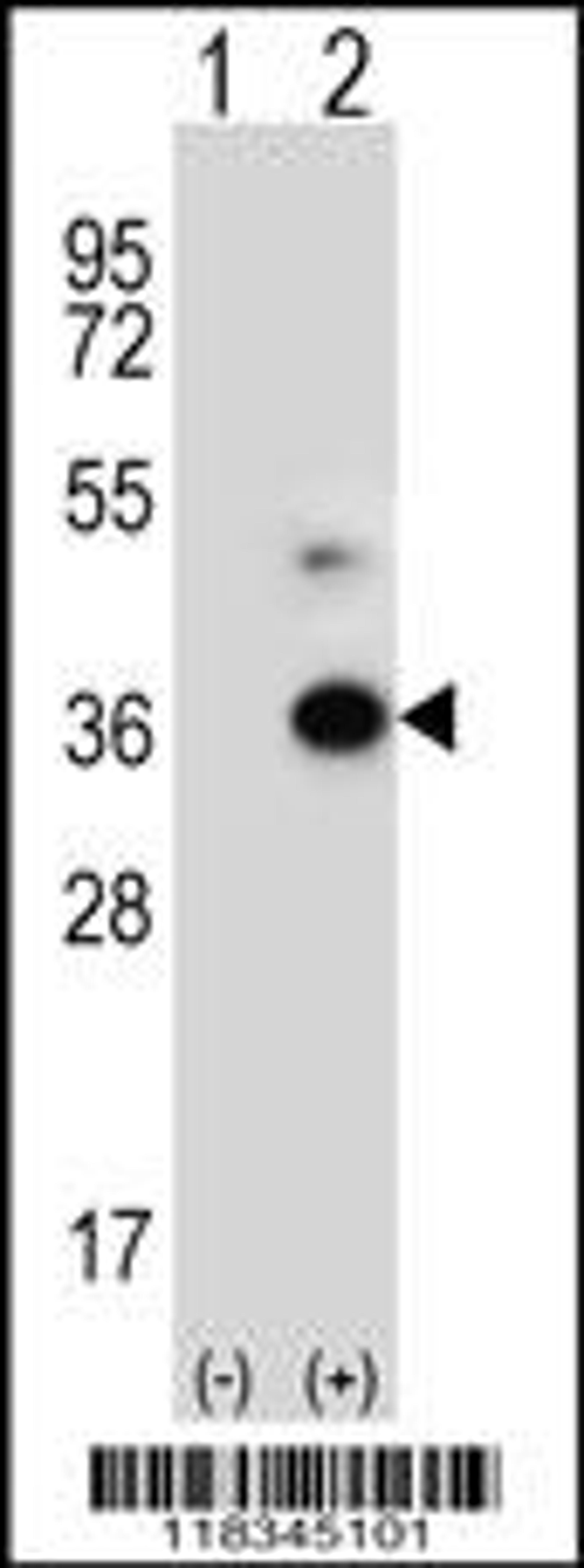 Western blot analysis of ANGPTL7 using rabbit polyclonal ANGPTL7 Antibody using 293 cell lysates (2 ug/lane) either nontransfected (Lane 1) or transiently transfected (Lane 2) with the ANGPTL7 gene.