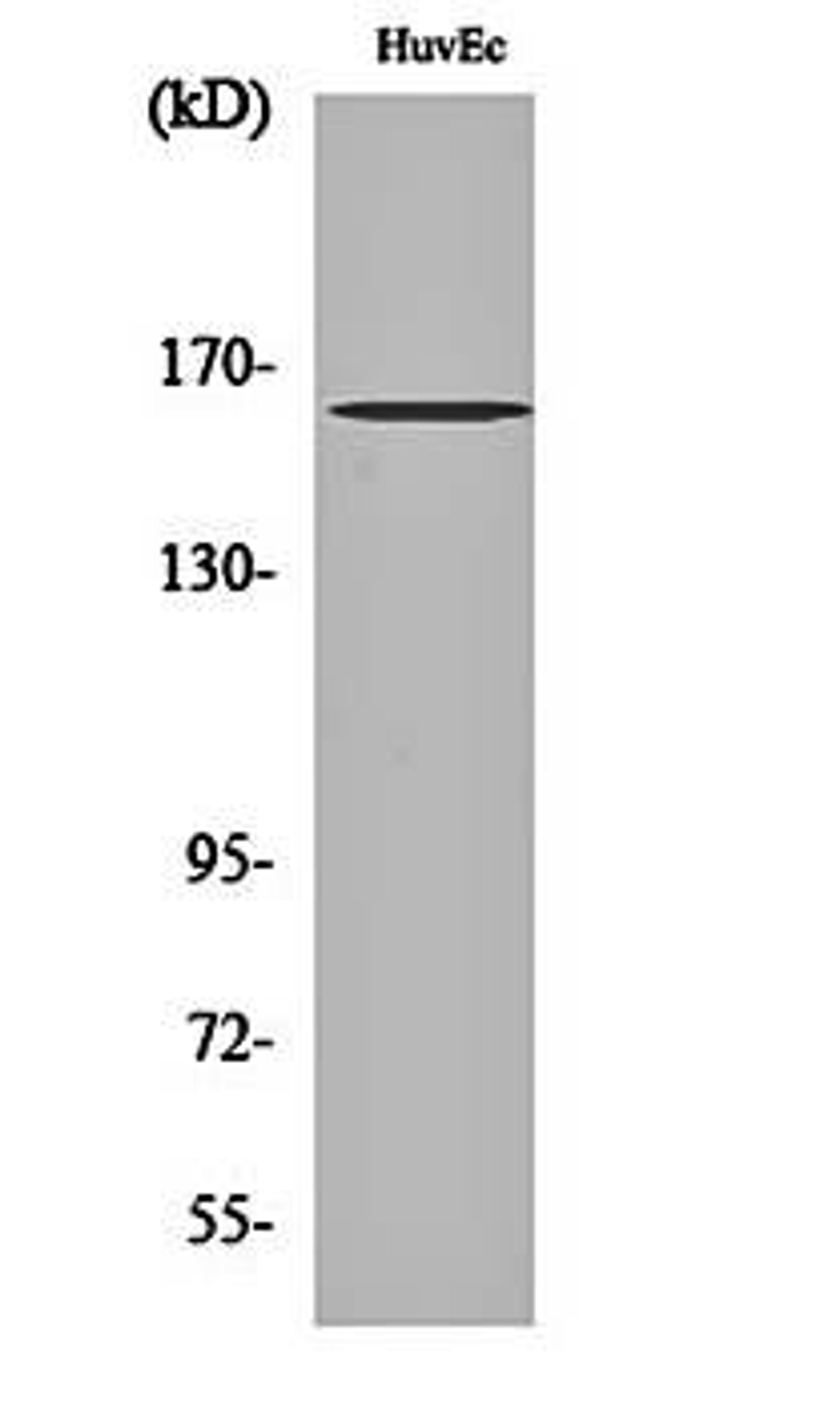 Western blot analysis of HuvEc cell lysates using Bcr (phospho-Y177) antibody