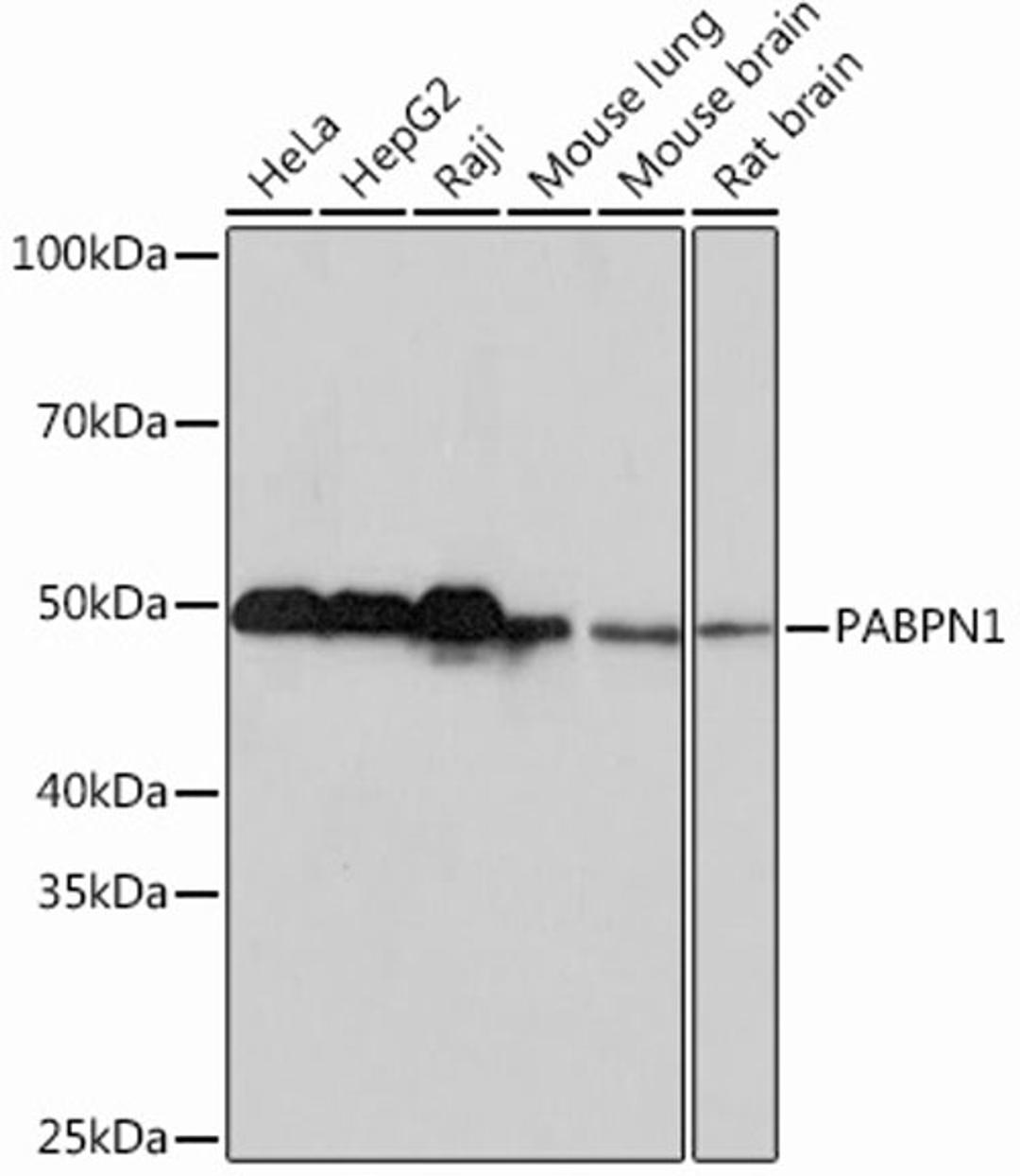 Western blot - PABPN1 Rabbit mAb (A1735)