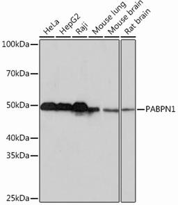 Western blot - PABPN1 Rabbit mAb (A1735)