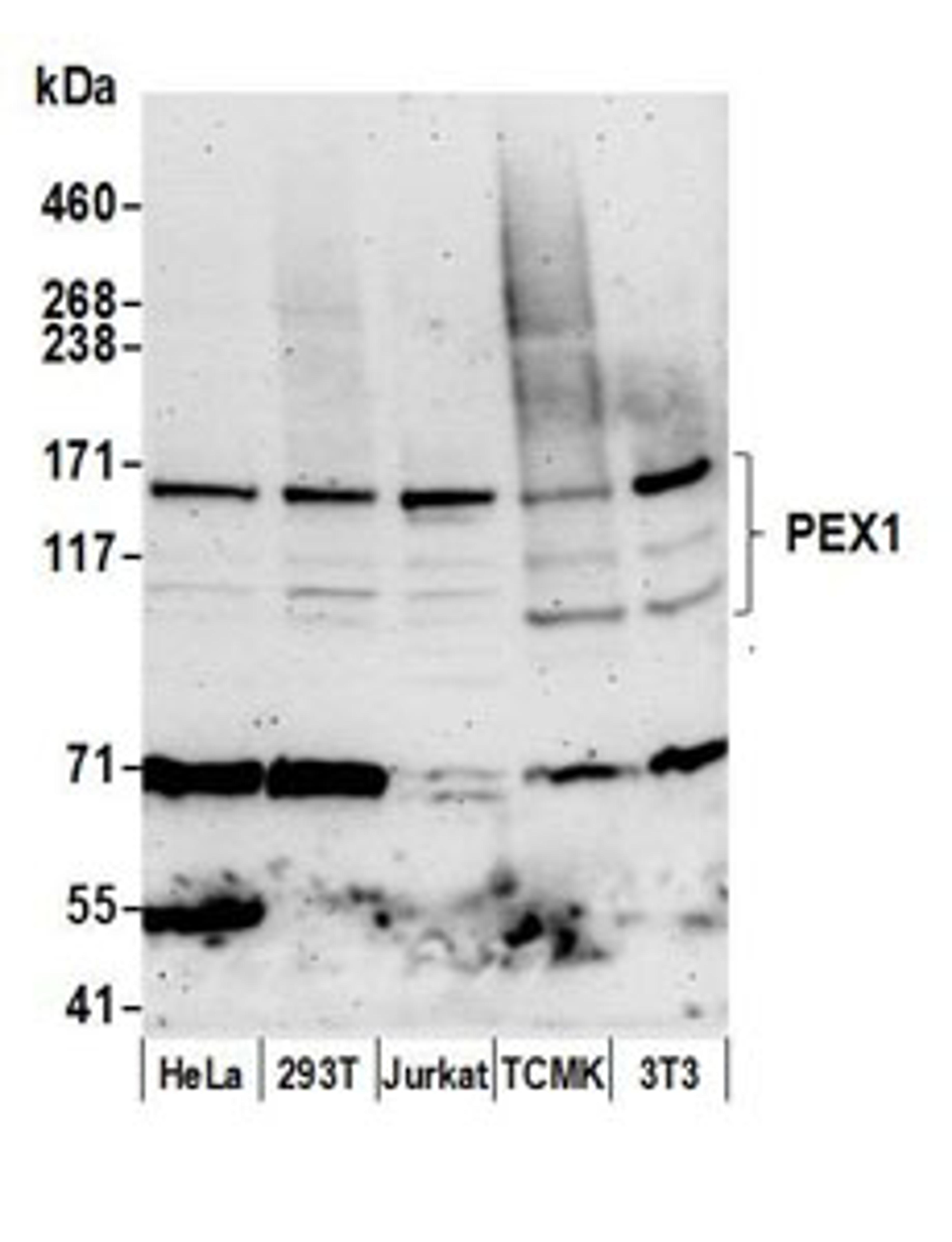 Detection of human and mouse PEX1 by western blot.