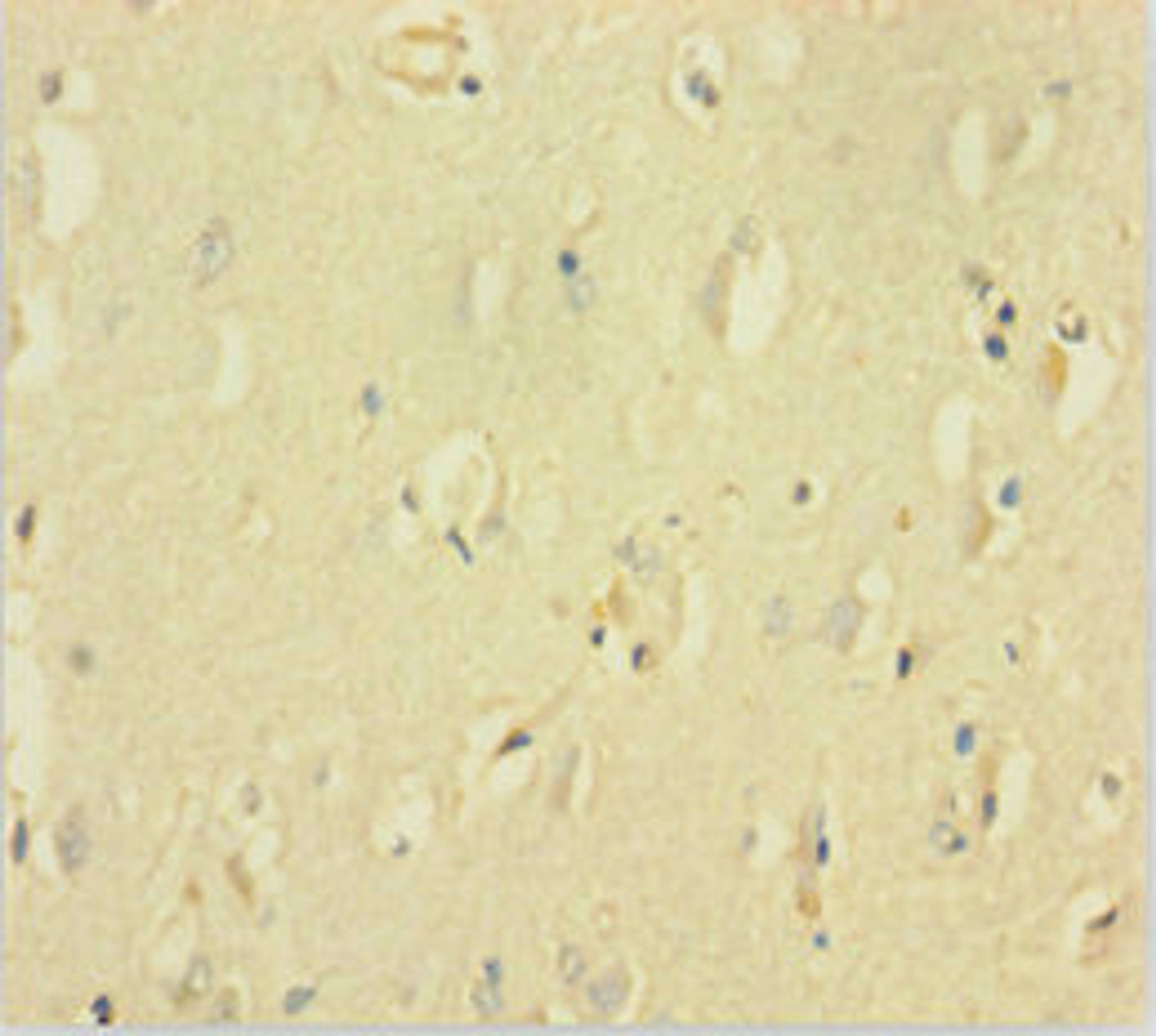 Immunohistochemistry of paraffin-embedded human brain tissue using CSB-PA891564LA01HU at dilution of 1:100