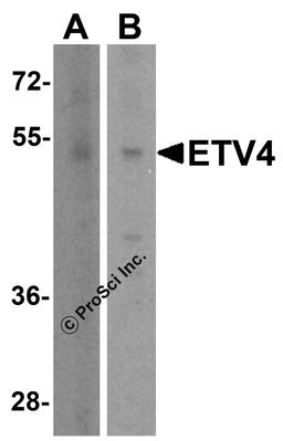 Western blot analysis of ETV4 in (A) human brain tissue lysate and (B) A431 cell lysate with ETV4 antibody at 1 μg/ml.