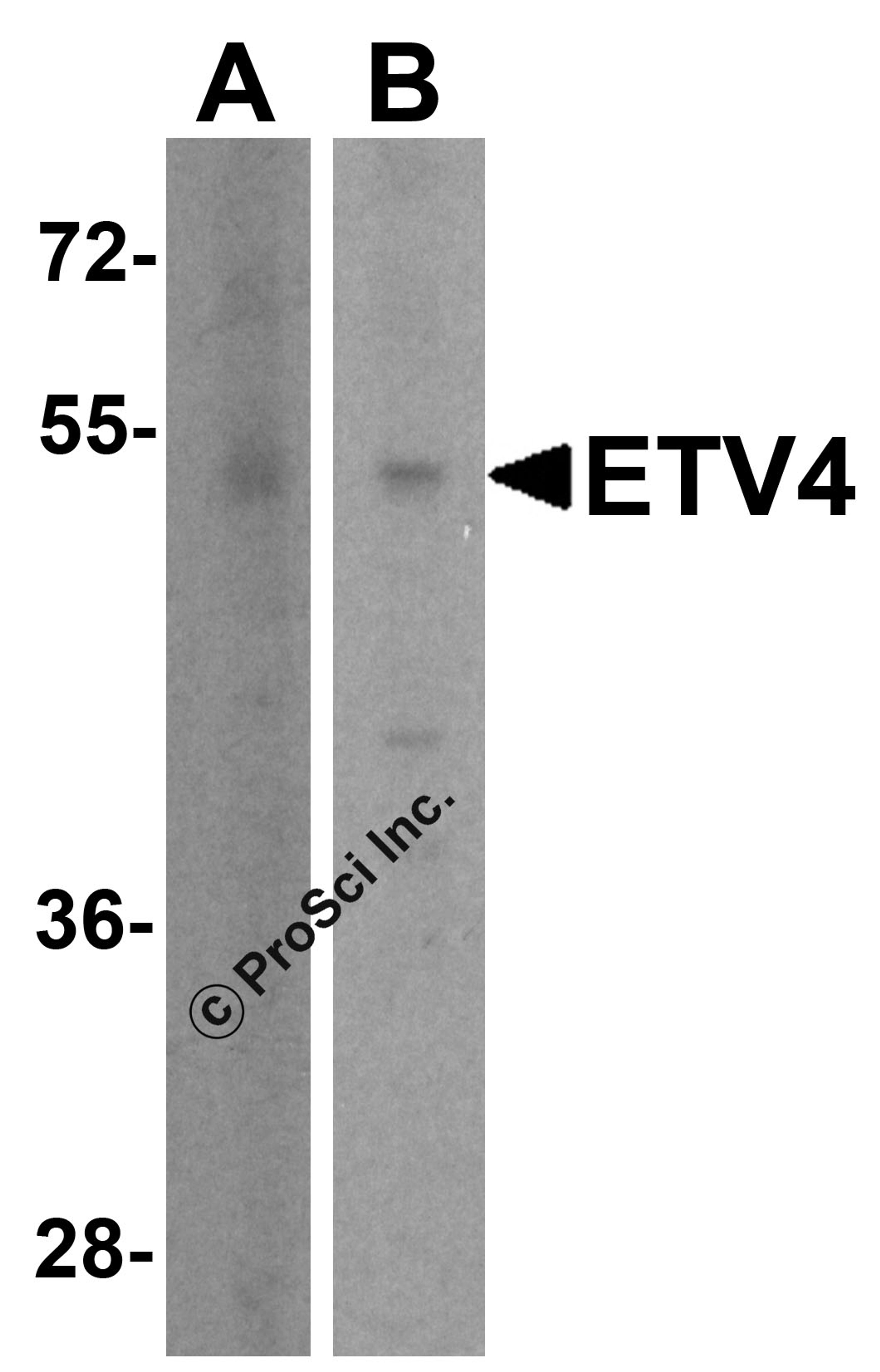 Western blot analysis of ETV4 in (A) human brain tissue lysate and (B) A431 cell lysate with ETV4 antibody at 1 μg/ml.
