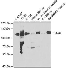 Western blot - SOX6 antibody (A7115)