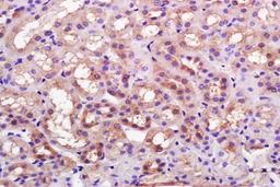 Paraffin-embedded rat kidney tissue fixed with 4% paraformaldehyde. Antigen retrieval by boiling with citrate buffer. Blocking buffer is goat serum (37 degrees for 20 min.). K Cadherin antibody at 1:200 dilution with overnight incubation at 4 degrees