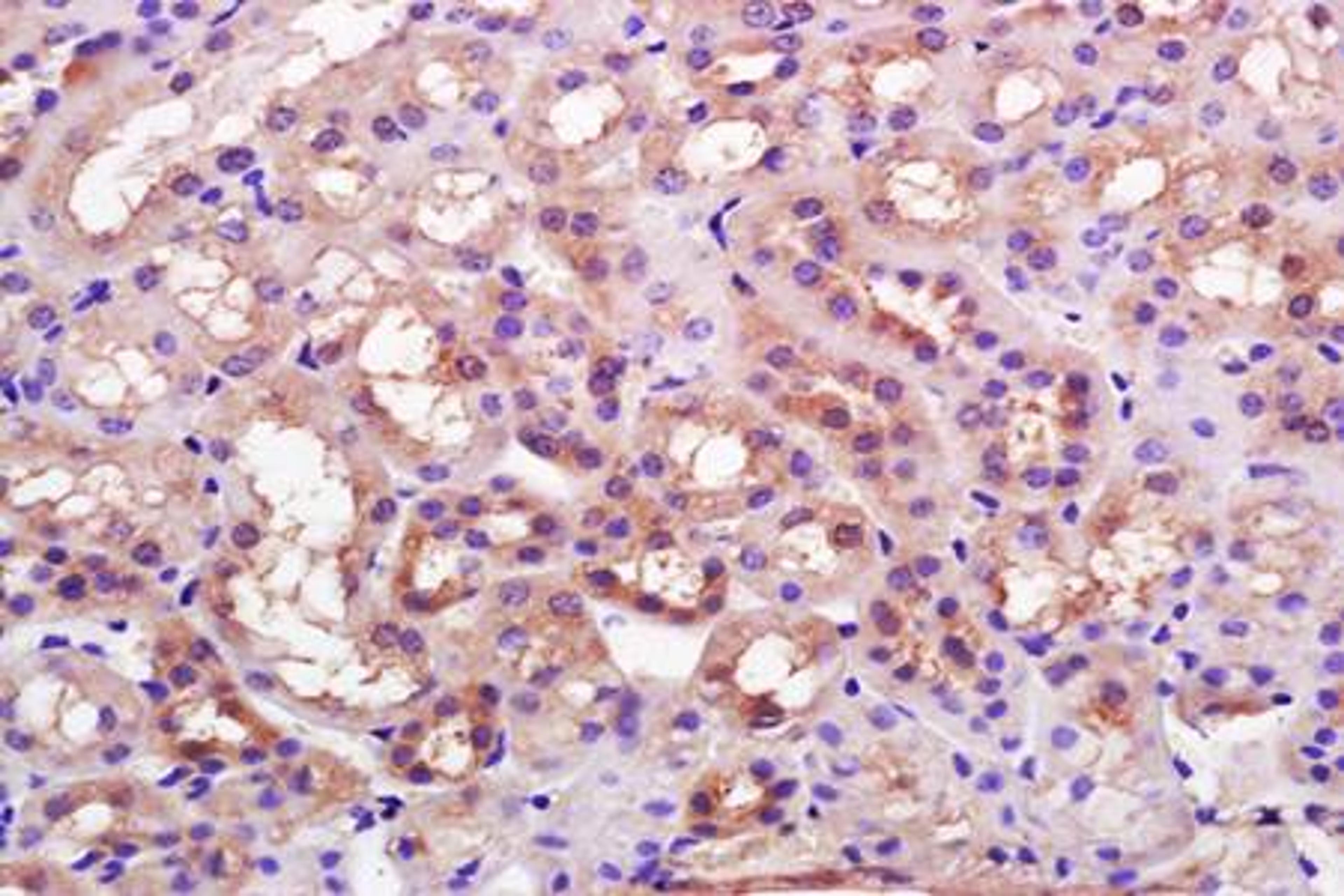 Paraffin-embedded rat kidney tissue fixed with 4% paraformaldehyde. Antigen retrieval by boiling with citrate buffer. Blocking buffer is goat serum (37 degrees for 20 min.). K Cadherin antibody at 1:200 dilution with overnight incubation at 4 degrees