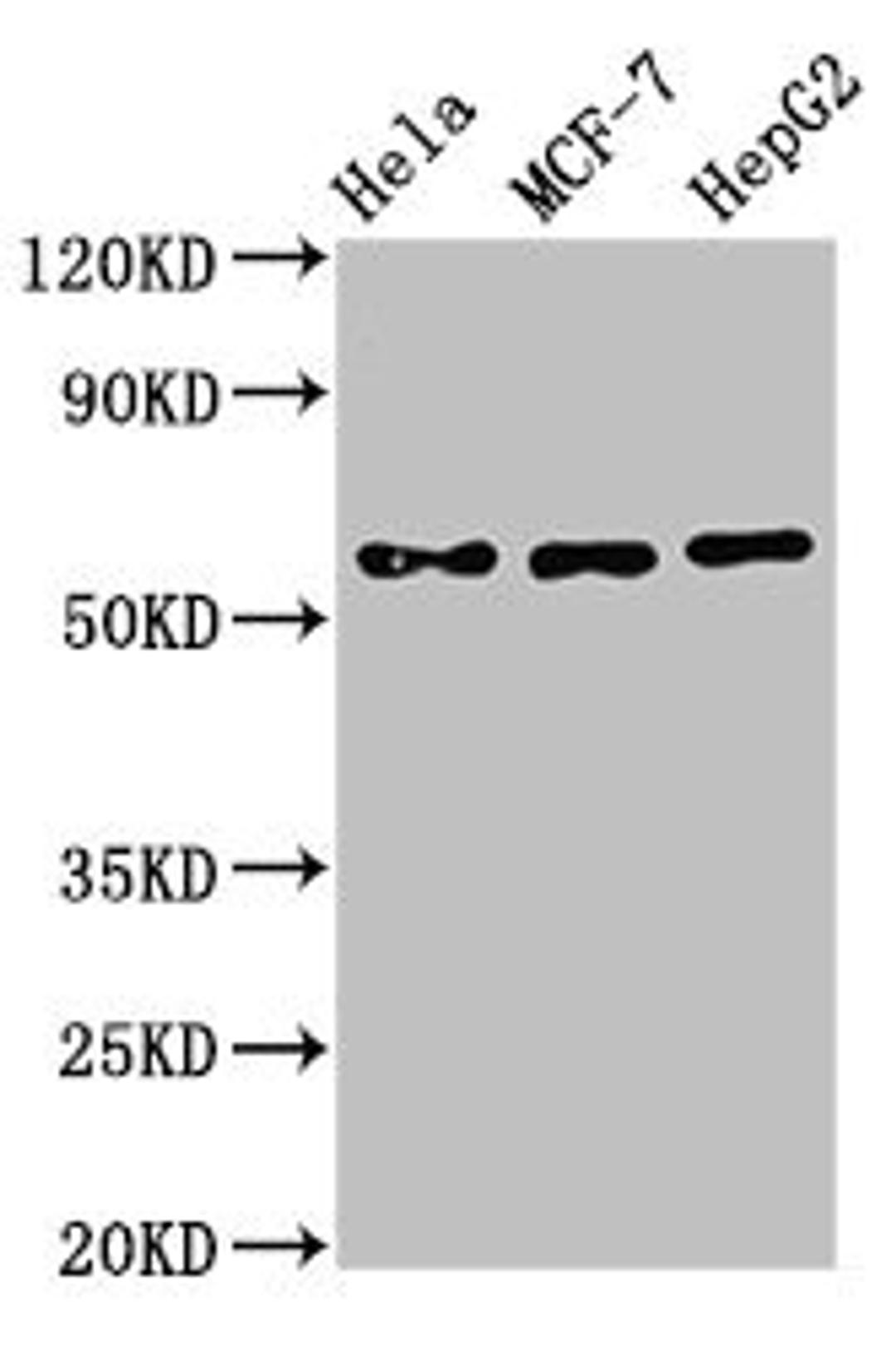Western Blot. Positive WB detected in: Hela whole cell lysate, MCF-7 whole cell lysate, HepG2 whole cell lysate. All lanes: CHRNB1 antibody at 3µg/ml. Secondary. Goat polyclonal to rabbit IgG at 1/50000 dilution. Predicted band size: 57, 50 kDa. Observed band size: 57 kDa