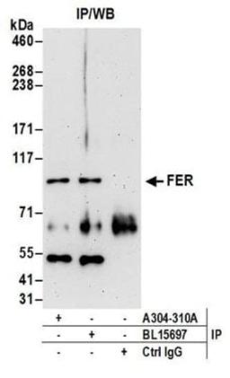 Detection of human FER by western blot of immunoprecipitates.