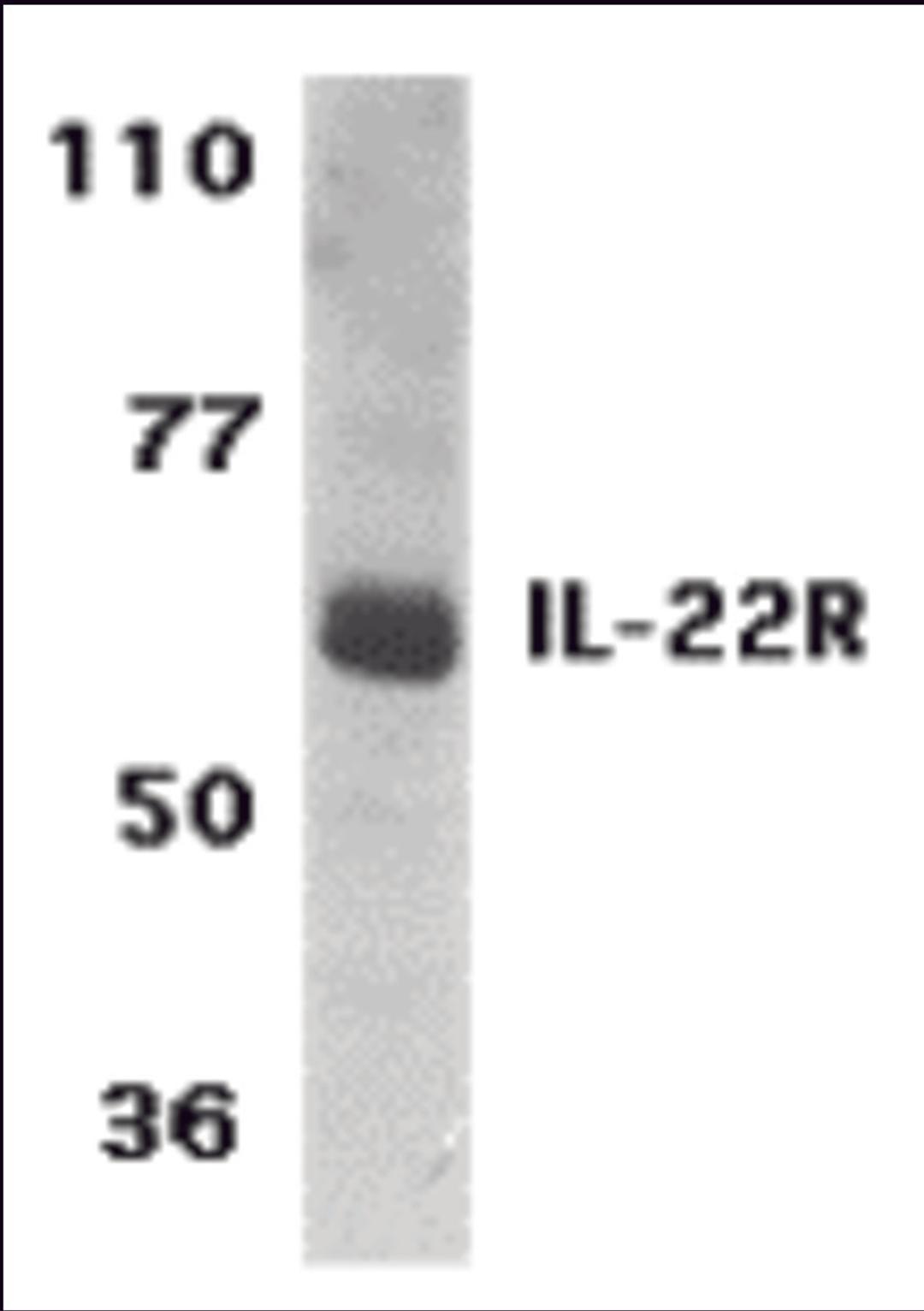Western blot analysis of IL-22 Receptor expression in human HepG2 cell lysate with IL-22 Receptor antibody at 1 μg /ml.