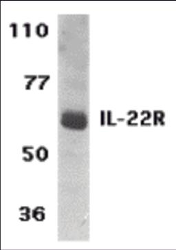 Western blot analysis of IL-22 Receptor expression in human HepG2 cell lysate with IL-22 Receptor antibody at 1 μg /ml.