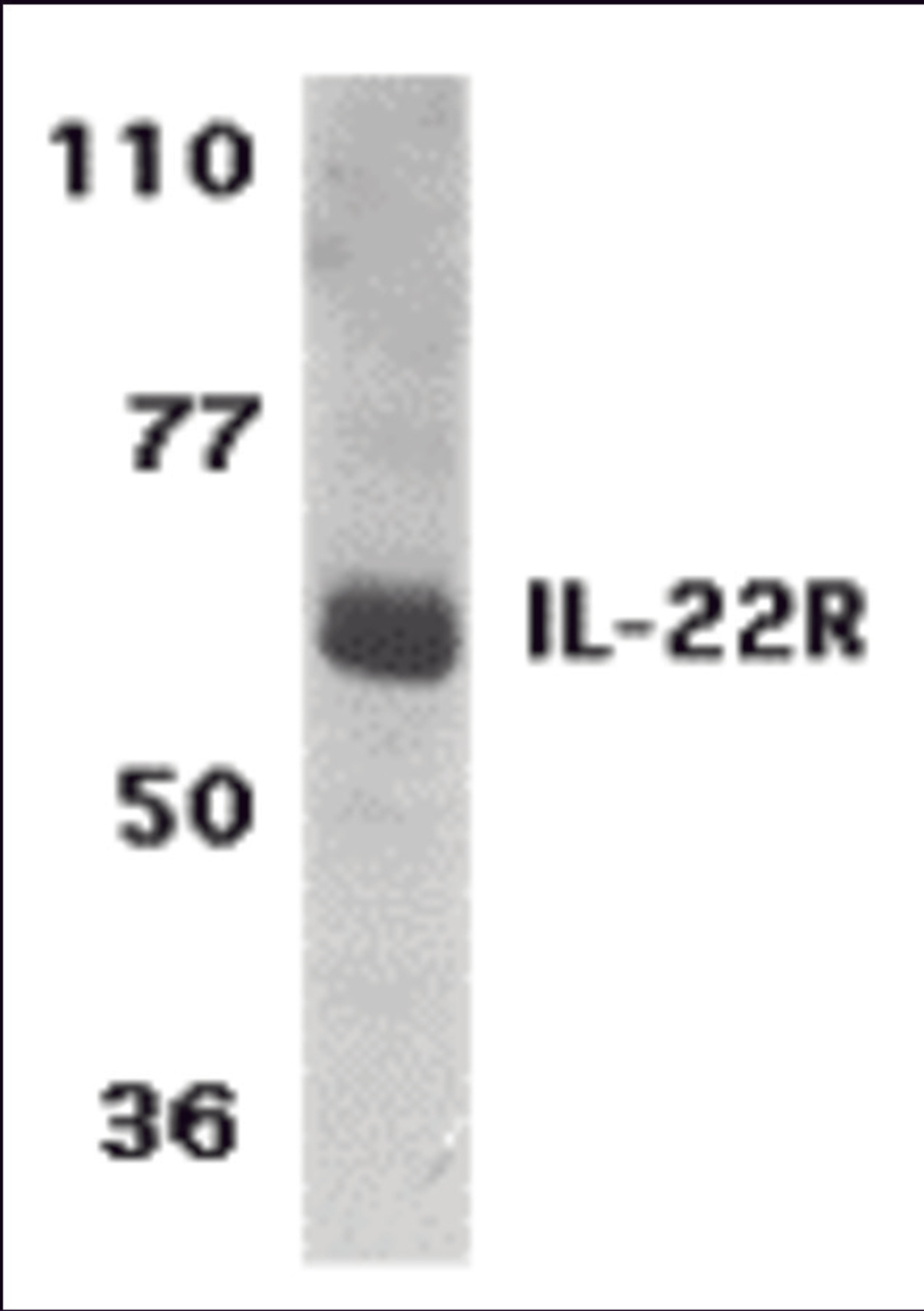Western blot analysis of IL-22 Receptor expression in human HepG2 cell lysate with IL-22 Receptor antibody at 1 μg /ml.