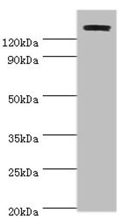 Western blot. All lanes: TP53BP2 antibody at 2ug/ml + Mouse thymus. Secondary. Goat polyclonal to rabbit IgG at 1/10000 dilution. Predicted band size: 126, 112, 127 kDa. Observed band size: 126 kDa. 