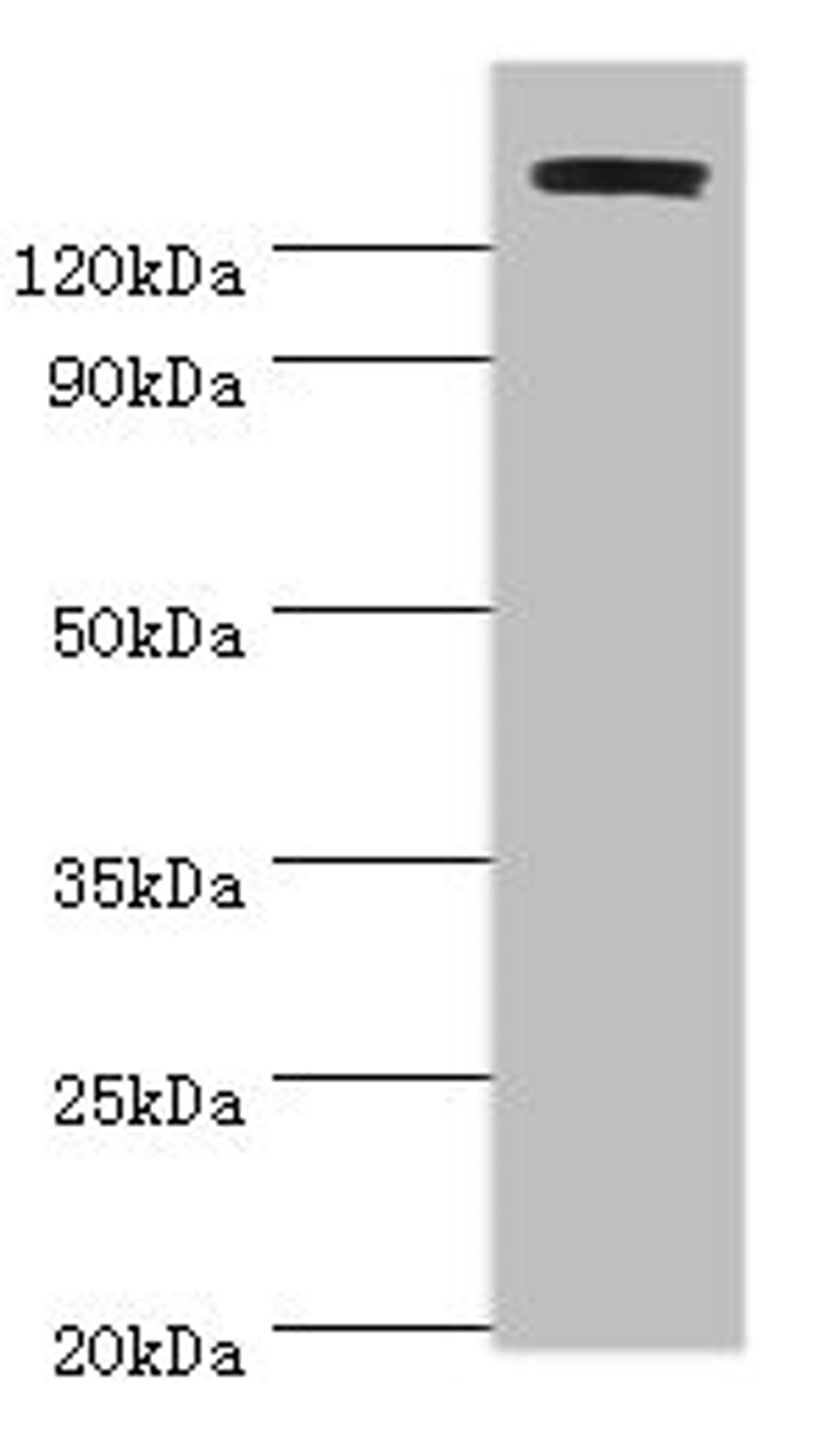 Western blot. All lanes: TP53BP2 antibody at 2ug/ml + Mouse thymus. Secondary. Goat polyclonal to rabbit IgG at 1/10000 dilution. Predicted band size: 126, 112, 127 kDa. Observed band size: 126 kDa. 