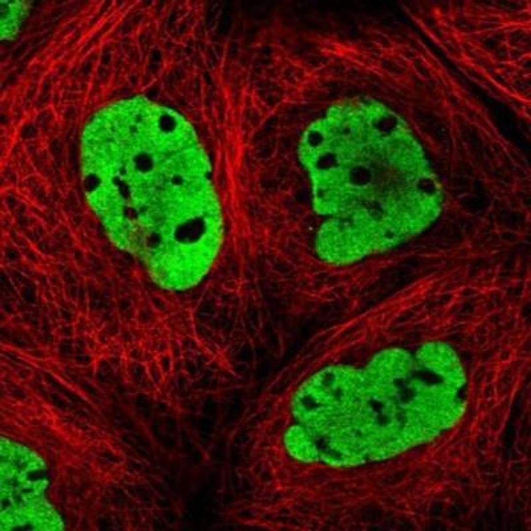 Immunocytochemistry/Immunofluorescence: DNMT3A Antibody [NBP1-85961] - Staining of human cell line A-431 shows positivity in nucleus but not nucleoli.