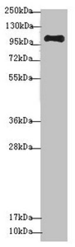 Western blot. All lanes: NAA25 antibody at 1.36 ug/ml + Mouse kidney tissue. Secondary. Goat polyclonal to rabbit IgG at 1/10000 dilution. Predicted band size: 113, 100 kDa. Observed band size: 113 kDa. 