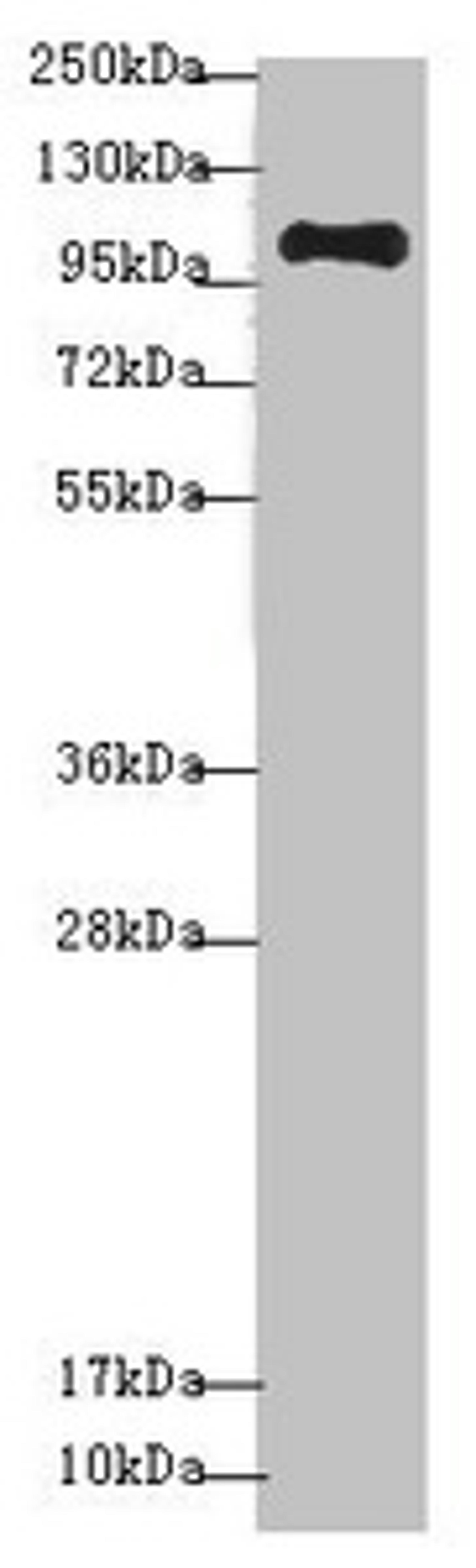 Western blot. All lanes: NAA25 antibody at 1.36 ug/ml + Mouse kidney tissue. Secondary. Goat polyclonal to rabbit IgG at 1/10000 dilution. Predicted band size: 113, 100 kDa. Observed band size: 113 kDa. 