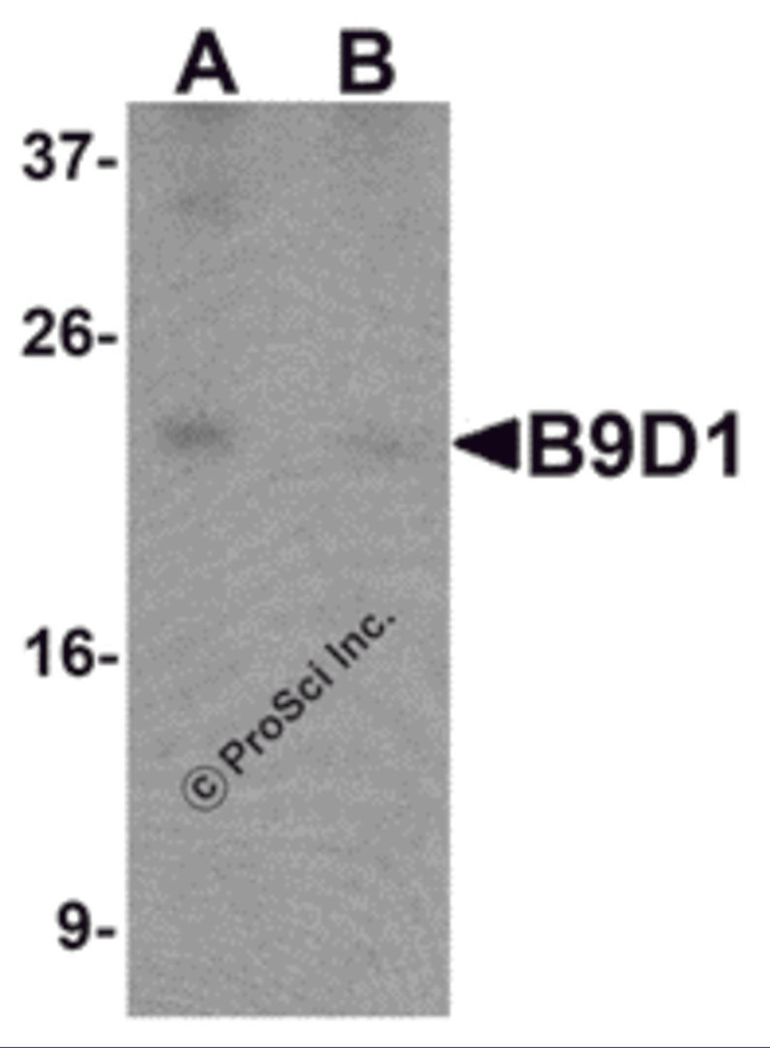 Western blot analysis of B9D1 in 293 cell lysate with B9D1 antibody at 1 μg/mL in (A) the absence and (B) the presence of blocking peptide.