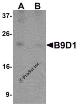 Western blot analysis of B9D1 in 293 cell lysate with B9D1 antibody at 1 μg/mL in (A) the absence and (B) the presence of blocking peptide.