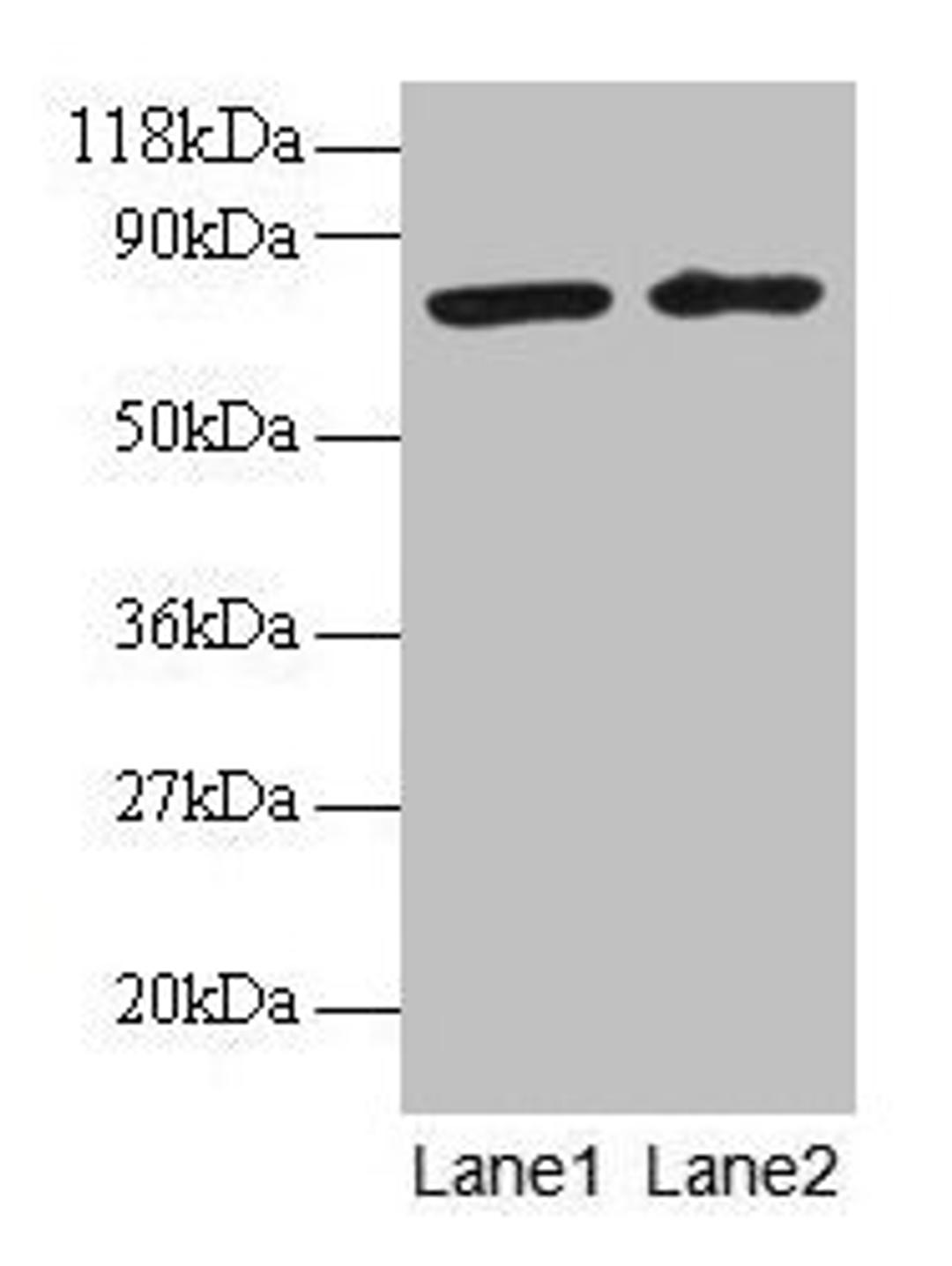 Western blot. All lanes: BLOC1S1 antibody at 2µg/ml. Lane 1: EC109 whole cell lysate. Lane 2: 293T whole cell lysate. Secondary. Goat polyclonal to rabbit IgG at 1/15000 dilution. Predicted band size: 18, 15 kDa. Observed band size: 75 kDa
