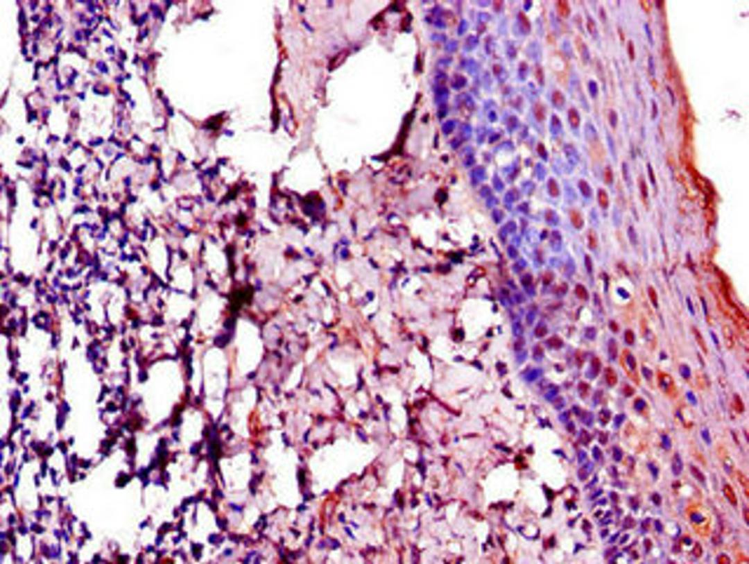 Immunohistochemistry of paraffin-embedded human tonsil tissue using CSB-PA896927LA01HU at dilution of 1:100