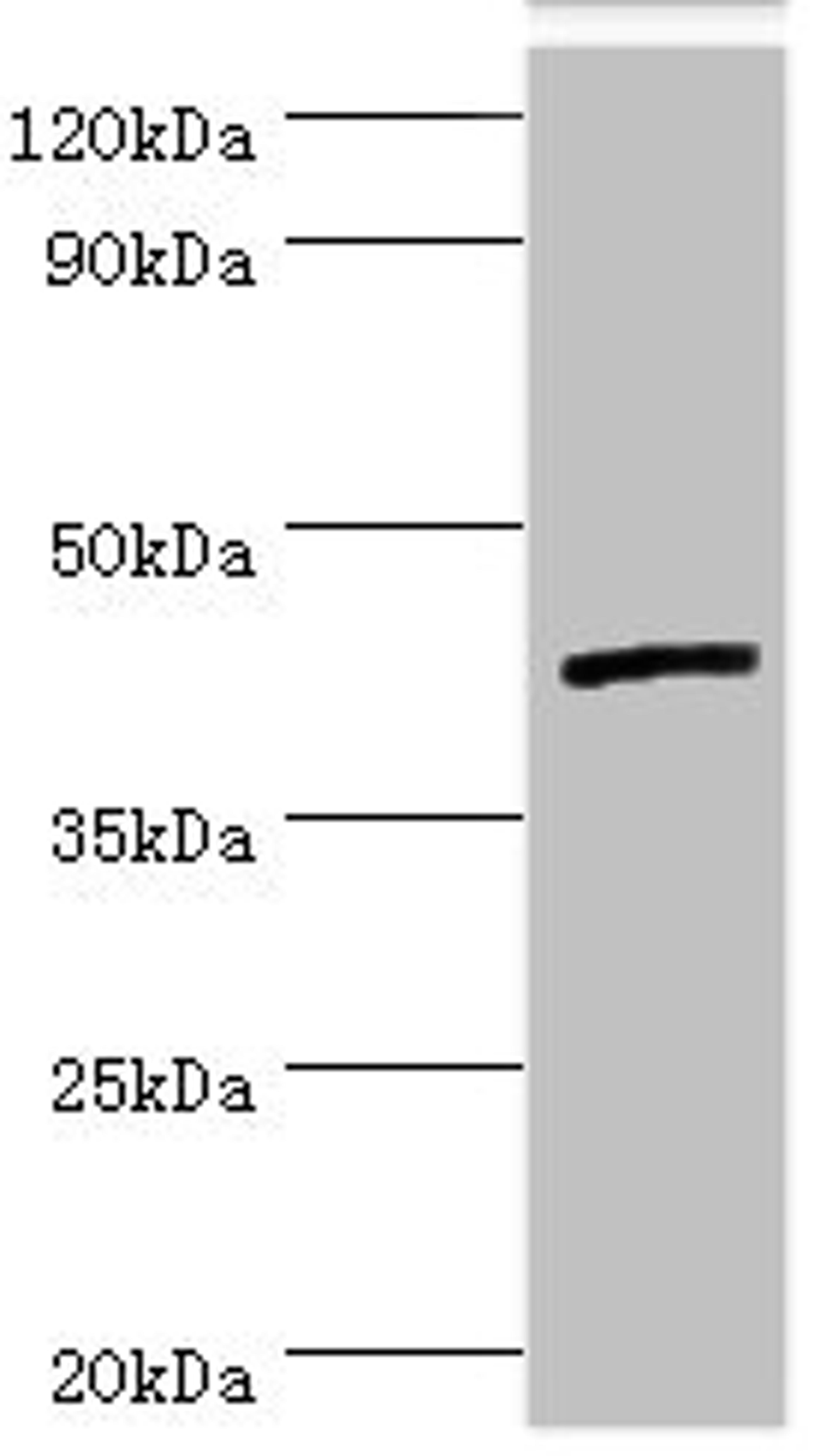 Western blot. All lanes: Interleukin-13 receptor subunit alpha-2 antibody at 5ug/ml + Hela whole cell lysate. Secondary. Goat polyclonal to rabbit IgG at 1/10000 dilution. Predicted band size: 44 kDa. Observed band size: 44 kDa. 